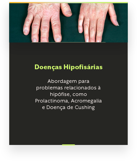[CJ] BOX HIPÓFISE